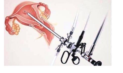 宮腔鏡檢查大概多少錢 宮腔鏡檢查的4大注意事項
