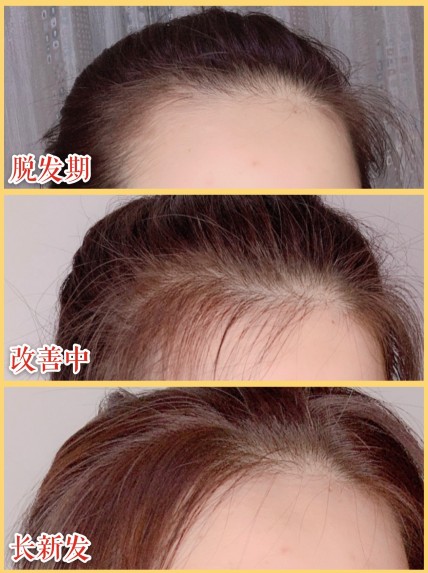 哪種洗發水好 學戚薇任性扎丸子頭少不了滋源