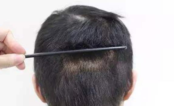 誰都不想提前衰老 男人提前衰老預防的方法介紹給你