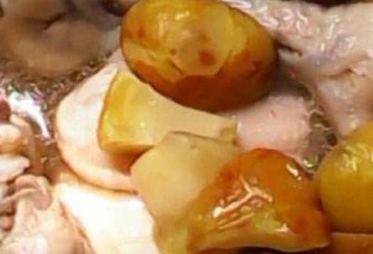 女性比男性更需要補腎 推薦2種女人能夠保護腎臟的食療方