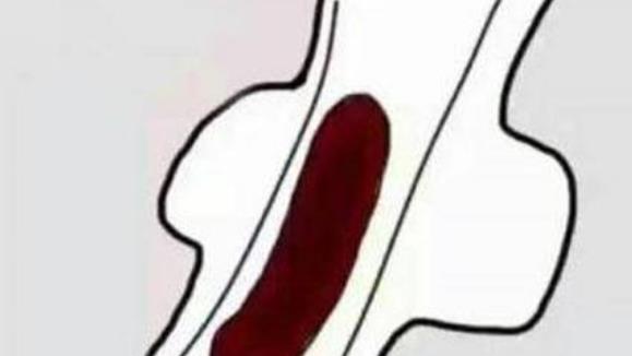 女性可以通過增加的經血判斷自己是否患病 介紹5種判斷方法