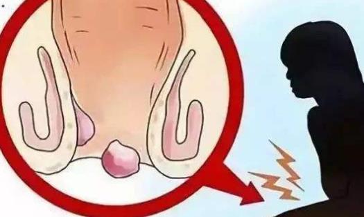 女生出現(xiàn)便秘很難受 推薦8種女性預防便秘的方法