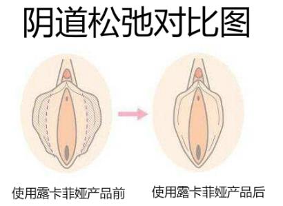 十大縮陰產品品牌排行榜,認準口碑好的品牌就夠了!