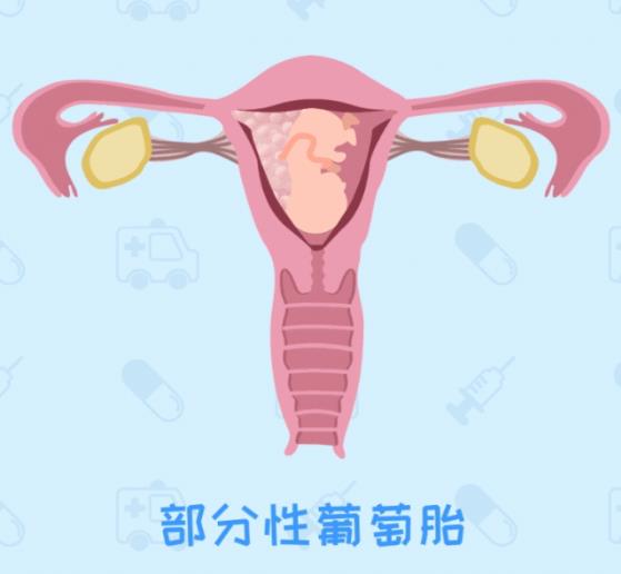 呼和浩特五洲醫(yī)院看病專(zhuān)業(yè)嗎 HCG升高一定是懷孕嗎不可能還有詐