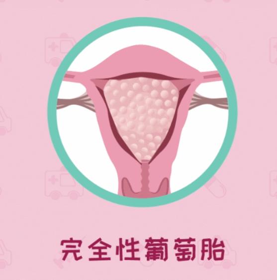 呼和浩特五洲醫(yī)院看病專(zhuān)業(yè)嗎 HCG升高一定是懷孕嗎不可能還有詐
