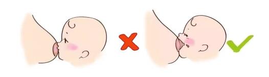 康哺樂(lè)®母乳益生菌預(yù)防、緩解哺乳期乳腺炎,全程守護(hù)母嬰健康!
