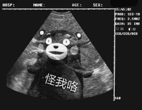 孕婦奶粉哪個品牌好 選對這個沒煩惱