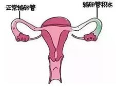 重慶送子鳥(niǎo)關(guān)懷健康行,孕路援助暖心間