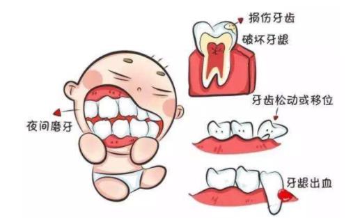 寶寶磨牙是因為肚里有蟲嗎 寶寶磨牙的食療方