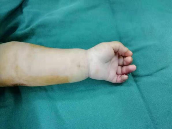 北京愛康醫療集團怎么樣?骨科專家溫馨提醒:家有幼兒,一定要小心這個“隱形”兇器
