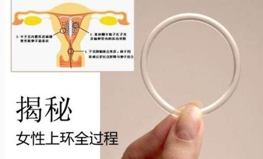 什么時候上環 上環的最佳時間