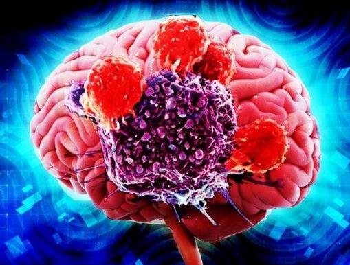 世界十大痛苦癌癥排行,胃癌發病率高,肺癌死亡率最快