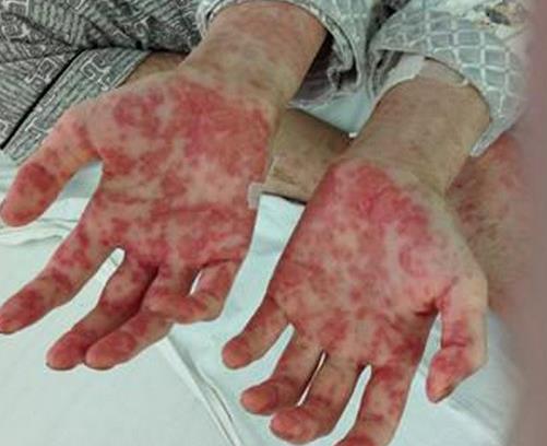 世界十大痛苦癌癥排行,胃癌發病率高,肺癌死亡率最快