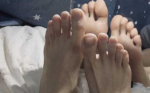 腳趾甲為什么會(huì)往肉里長(zhǎng) 腳趾甲不好和肝臟有關(guān)系嗎