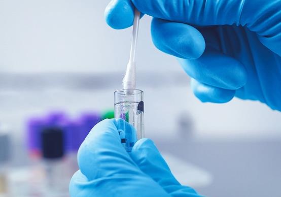 自己可以進行核酸檢測的采樣嗎?核酸檢測方法有幾種?