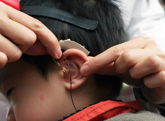 人工耳蝸需要開顱嗎?做人工耳蝸影響睡眠嗎