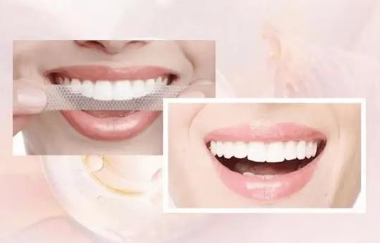 美白牙貼飯前貼還是飯后貼?美白牙貼可以貼在內側嗎