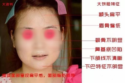 大餅臉是什么意思?一個人臉大的原因 大餅臉的瘦臉方法
