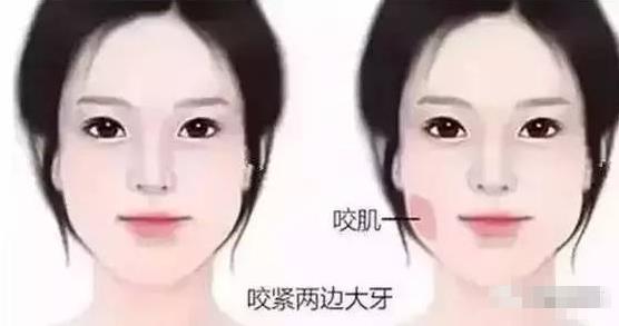 大餅臉是什么意思?一個人臉大的原因 大餅臉的瘦臉方法