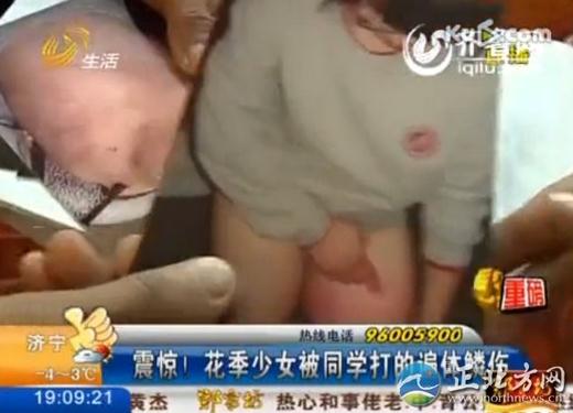 16歲花季少女被四名室友毆打4小時，脫光了跪在地上打，打得遍體鱗傷