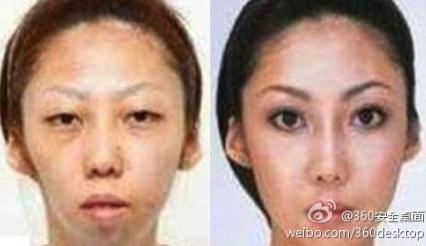 【老婆太丑】老婆漂亮女兒太丑，男子告整容老婆獲賠75萬，是整容醫(yī)院炒作嗎