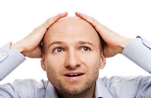 禿頂?shù)脑?七個習慣防止男人禿頂