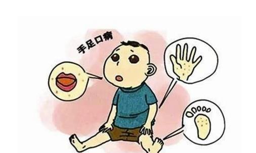 什么是手足口???手足口病怎么治療