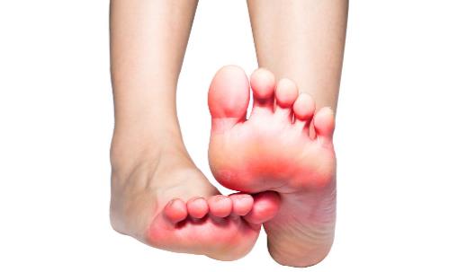 有腳氣的人，經常用鹽水泡腳就能消滅真菌嗎？它沒有這個