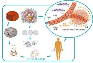 廣州復大腫瘤醫(yī)院牛立志教授：癌癥治療技術(shù)——血管介入療法