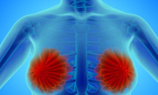 乳腺結節一定要切除嗎 需要及時手術治療的情況