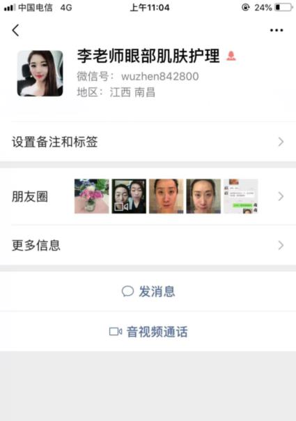 幻柔筆記：眼袋修復后氣質立現，怎么看都是青春靚麗！