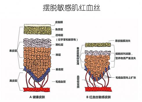 放心！有美薏升修復敏感肌紅血絲專家產品在，你每天都可以美美噠